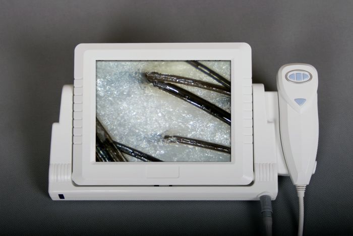 佳宜通JYtop8寸液晶屏虹膜检测仪一体机 虹膜分析仪 放大镜 虹彩仪，虹膜机EH3000