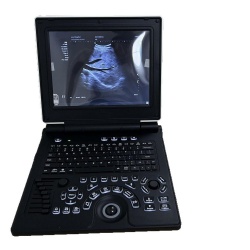 JYTOP 12 Inch HD Display Ultrasound Scanner Portable Color Doppler 3D Ultrasound Pregnancy Machine Product Description